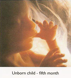 5 month unborn child